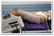 Electrolipolyse