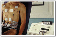 Electrostimulation